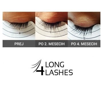 Long4Lashes GOLD serum za rast trepalnic (Serum za trepalnice Long4Lashes)