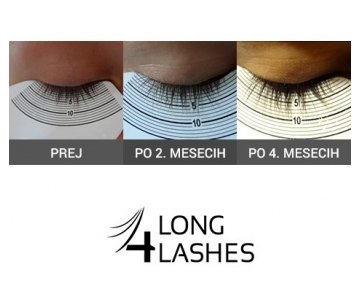 Long4Lashes GOLD serum za rast trepalnic (Serum za trepalnice Long4Lashes)