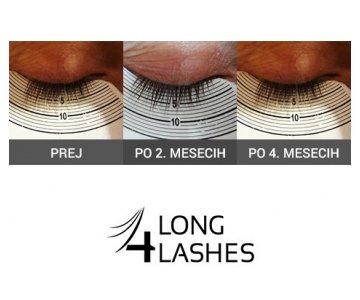 Long4Lashes GOLD serum za rast trepalnic (Serum za trepalnice Long4Lashes)