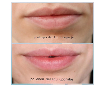 DermoFuture Lip Filler - Plumper balzam za ustnice (Klara M. deli svoje izkušnje!)