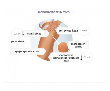 Nacomi Anti Cellulite & Slimming losjon za telo