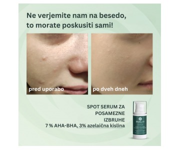 BasicLab Dermocosmetics Anti-Acne Spot Serum s 7% AHA in BHA kislinami in cica izvlečki